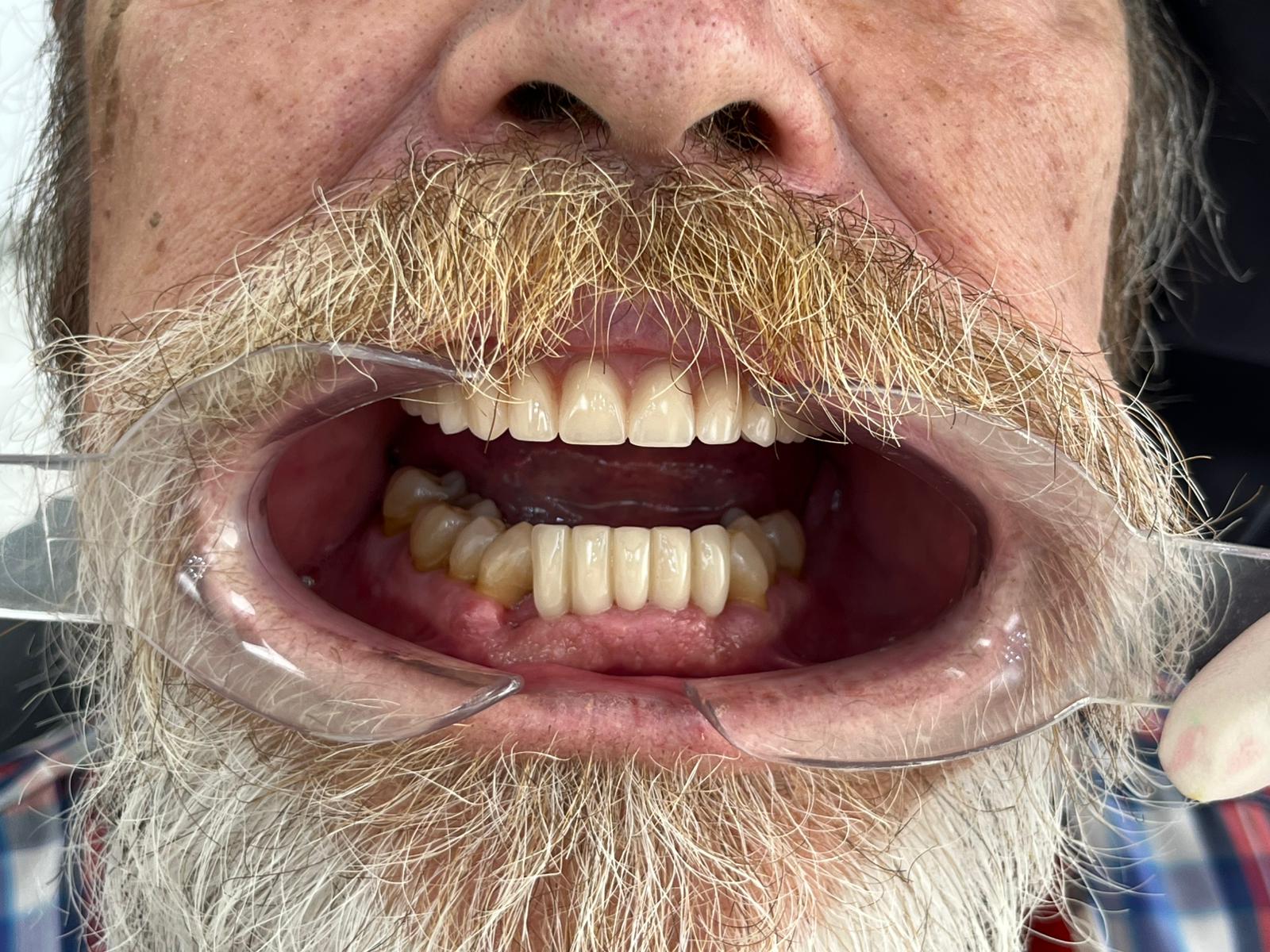 Tratamiento de ortodoncia